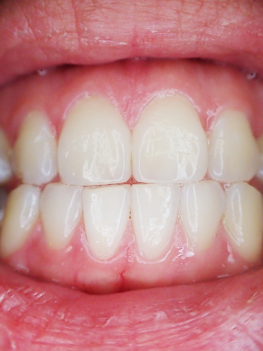 Good dental hygiene helps keep teeth healthy